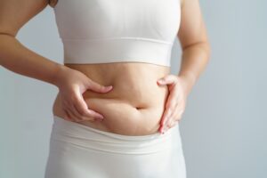 Best Tummy Tuck Cost and Results Near Latham