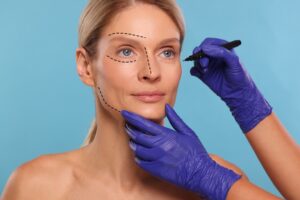 Deep Plane Facelift Technique